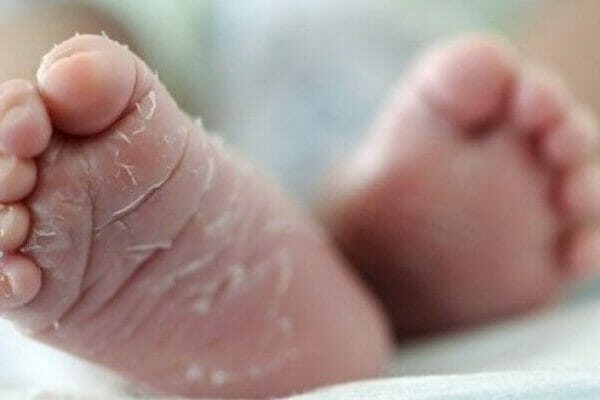 Newborn-feet-peeling-002-ows8xbwkxvyyaknjtnksd60xmyhqcs64jmq5r1evts